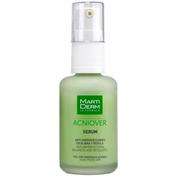 Martiderm acniover serum (30 ml)